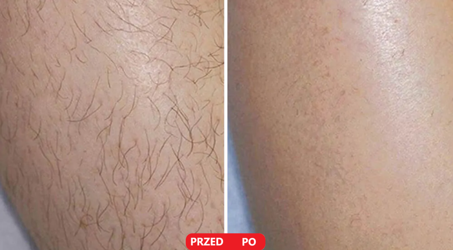Efekty użycia — zdjęcie 1