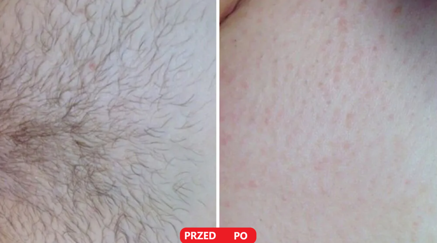 Efekty użycia — zdjęcie 2